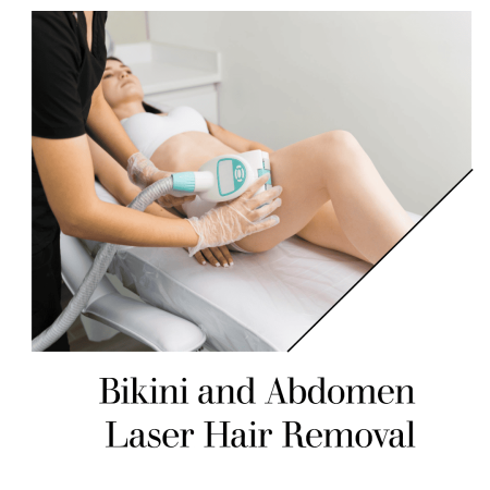 Bikini laser hair removal Sheer Elegance